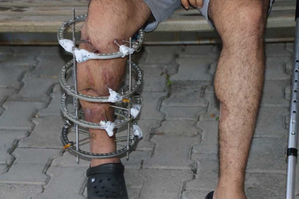 Adıyamanlı çiğköfteci Antalya’da yaşadığı silahlı saldırıyı anlattı: ‘Can güvenliğim tehlikede’